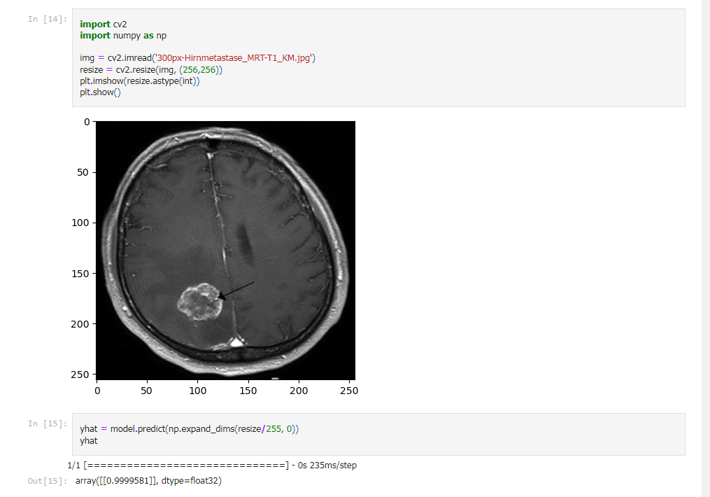 Brain Tumor MRI Classification